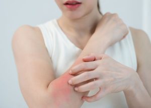 Cách chọn nệm an toàn cho người dễ bị dị ứng hóa chất